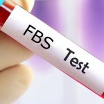 آزمایش fbs چیست؟
